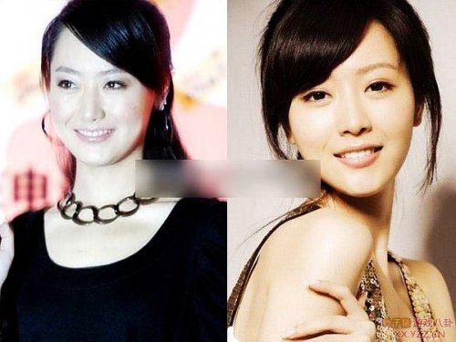 娱乐圈女明星大饼脸惊变锥子