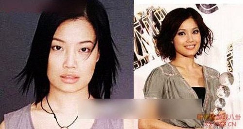 娱乐圈女明星大饼脸惊变锥子